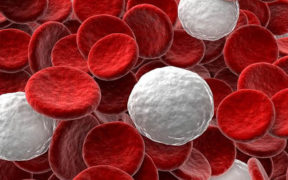 Nedostatok bielych krviniek / leukocytov